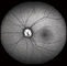 Cámara confocal del fondo de Opthalmoscope Digital de la retina con FOV 15°, 30°, talla 1024*1024 de la imagen 60°