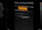 Echo Handheld Color Doppler Linear explora frecuencia de la arteria carótida 7.5-10MHz