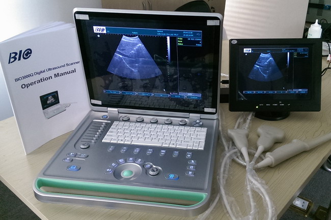 ordenador portátil B de 3D Digitaces/escáner portátil del ultrasonido de W con las puntas de prueba transvaginales lineares convexas