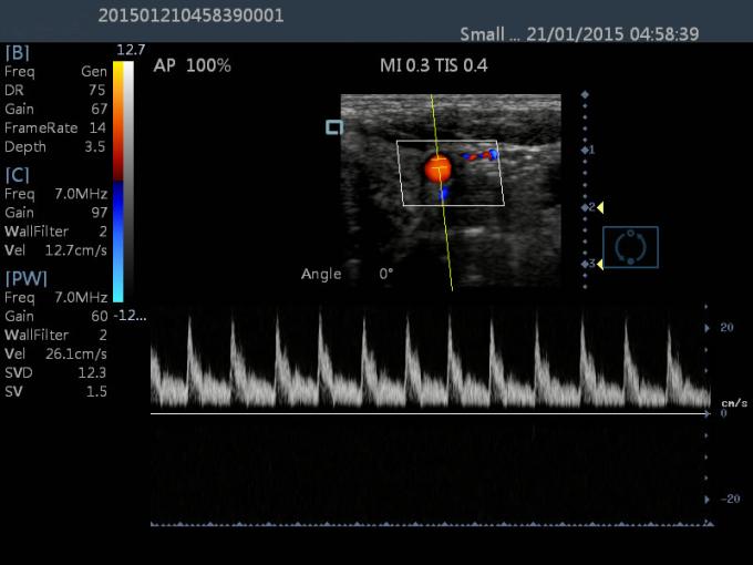 15 dispositivo de diagnóstico portátil del ultrasonido de la máquina de Dopple del color del ultrasonido del LCD 2.o del tacto de la pulgada