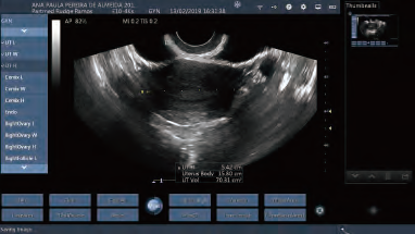 Dispositivos de diagnóstico ultrasónicos portátiles del ultrasonido de la punta de prueba del ultrasonido del color inalámbrico transvaginal de la punta de prueba