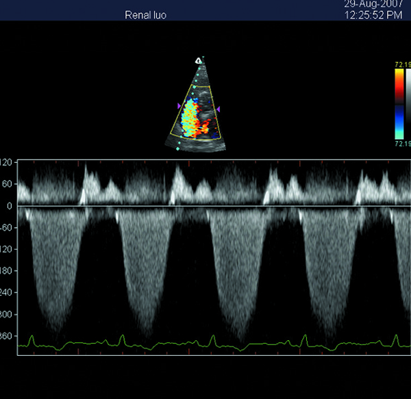 Escáner portátil del ultrasonido de Doppler del color de la máquina del ultrasonido 3D con la pantalla de 15 pulgadas LED