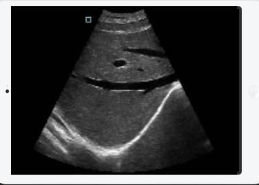 Punta de prueba cardiaca linear convexa del ultrasonido de la punta de prueba de la punta de prueba inalámbrica transvaginal del ultrasonido desmontable