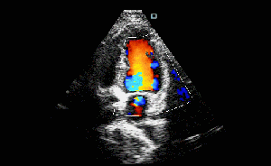 Escáner médico del ultrasonido de Doppler del color de la máquina de la exploración del ultrasonido con el transductor cardiaco