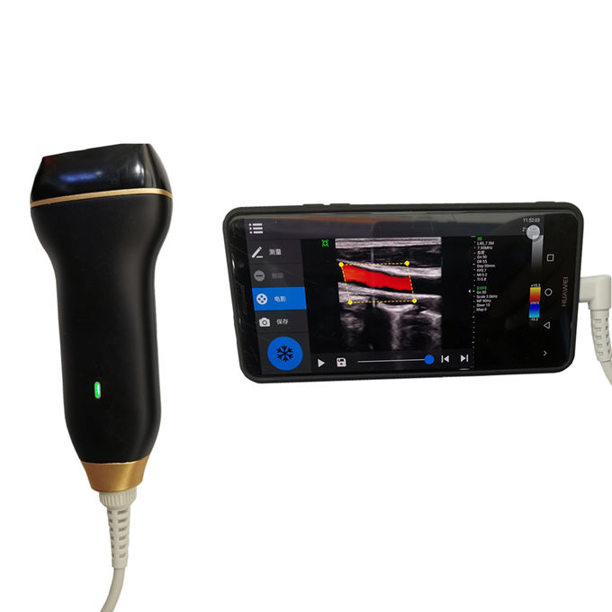 Escáner casero del ultrasonido de Doppler del color de la máquina de la proyección de imagen del ultrasonido con la conexión USB