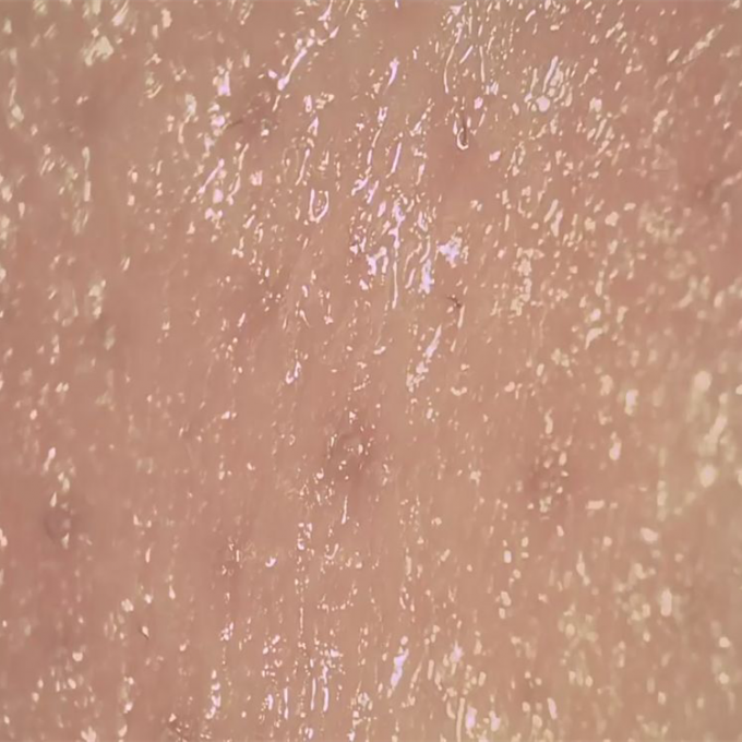 Analizador inalámbrico de la piel de Digitaces del detector de la humedad de la piel para observar la superficie de los poros de Derm de la piel