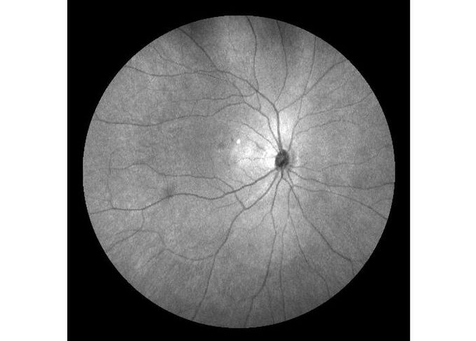 equipo oftálmico Ultra-ancho de Angiograph Digital de la retina de la exploración del laser del campo con el zoom óptico 100°/60°/30°