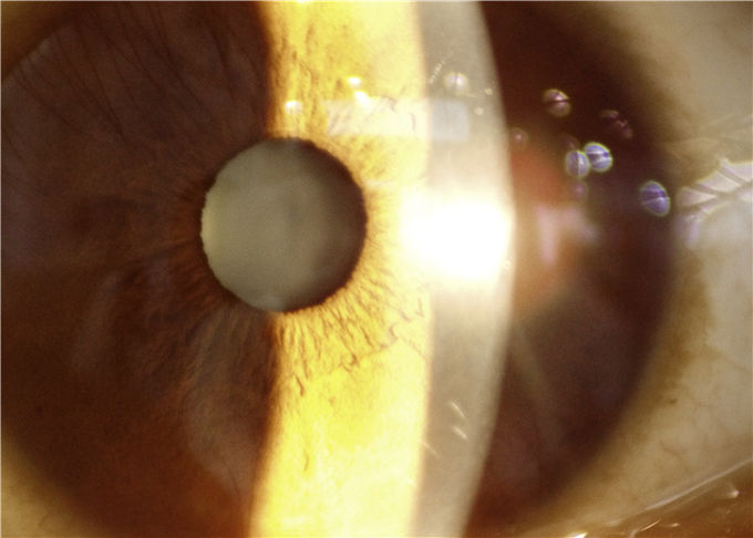 Lámpara rajada portátil del dispositivo de la oftalmología del uso de la telemedicina con la anchura rajada 0-12m m continuamente ajustables