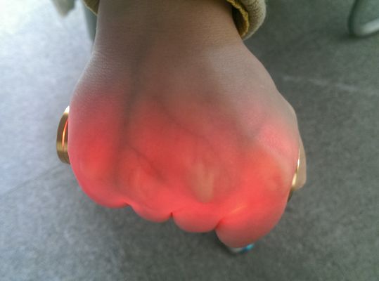 Aluminio de oro del proyector de Venipuncture de la vena del buscador del localizador infrarrojo vascular portátil de la vena