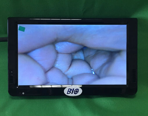 Colposcopio electrónico digital portátil