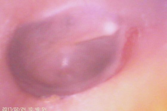 720X480 Otoscopio de vídeo digital