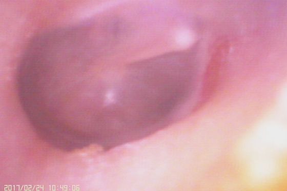 720X480 Otoscopio de vídeo digital