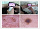 Inspección ENT clínica del otoscopio video de Digitaces del cuerpo humano con el otoscopio de TFT LCD USB del color