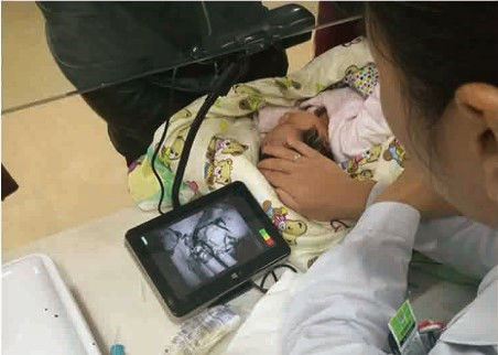 Buscador infrarrojo económico portátil de la vena que detecta la profundidad cerca de 10m m de la carretilla de la vena disponible