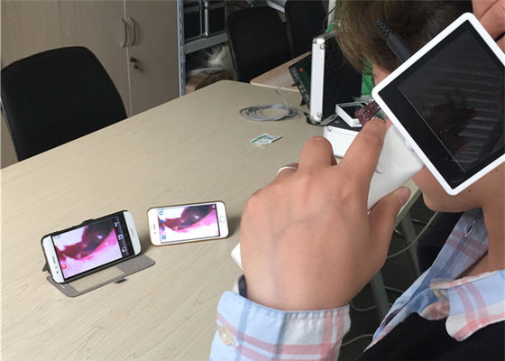 720X480 Otoscopio de vídeo digital