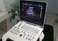 Equipamiento médico del ultrasonido de la máquina del ultrasonido de Doppler del color con 5 idiomas de las clases
