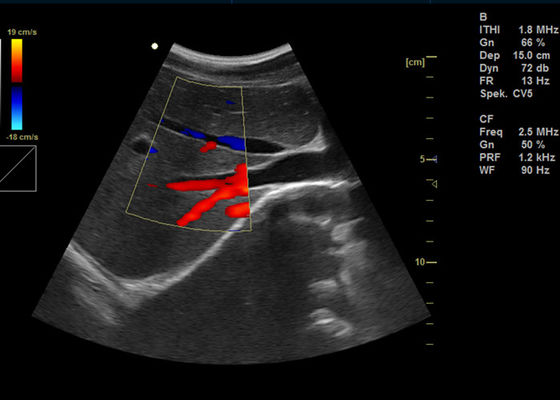 ultrasonido portátil de la proyección de imagen de Doppler del color de 15 Digitaces de la pulgada de la máquina llena de Doppler con el puerto de USB 2