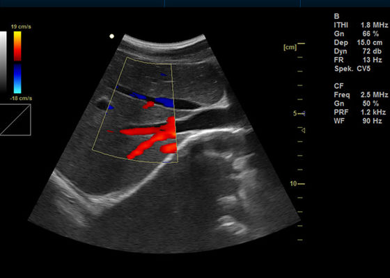 ultrasonido portátil de la proyección de imagen de Doppler del color de 15 Digitaces de la pulgada de la máquina llena de Doppler con el puerto de USB 2
