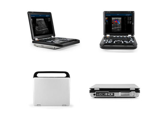 Escáner humano de diagnóstico del ultrasonido de la máquina de Doppler del color de 15 pulgadas LED con la conexión de 2 puntas de prueba