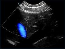 Escaneador de ultrasonido mini de bolsillo