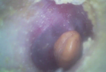 Otoscopio video de Digitaces del PDA económico ENT portátil del alcance con la tarjeta flash micro del SD de 32G