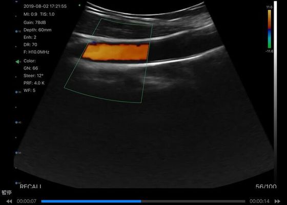 Escáner de ultrasonido portátil digital inalámbrico