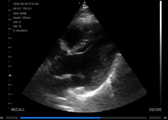 Escáner de ultrasonido portátil digital inalámbrico