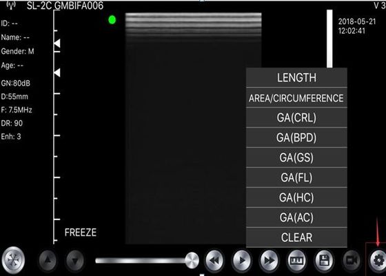 cuerpo del escáner del ultrasonido del PDA 5G: 3.5~5MHz, linear: 7.5~10MHz, cardiaco: 2.5~5MHz
