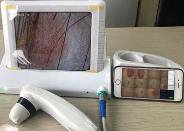 Analizador portátil de la humedad de la piel de Digitaces con el APP transferido al móvil